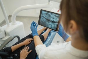 A Dentist Showing a Dental X-ray